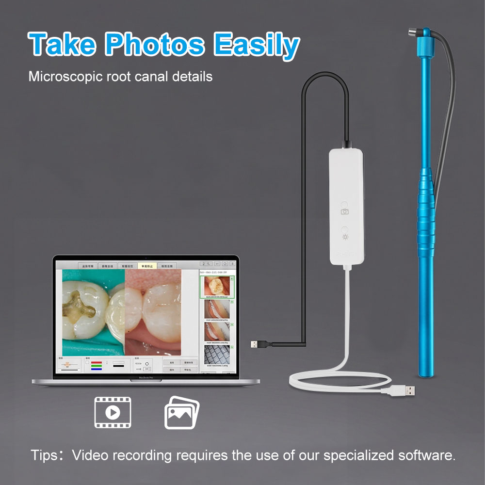 5MP Micro Intraoral Camera Den – Mini Electronics Gadgets recenzja i cena